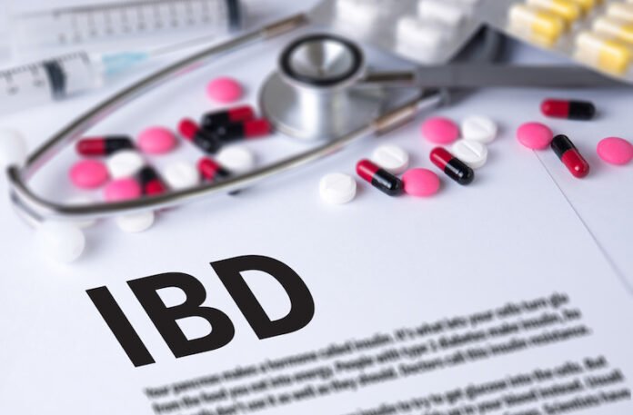 IBD - Inflammatory Bowel Disease. Medical Concept